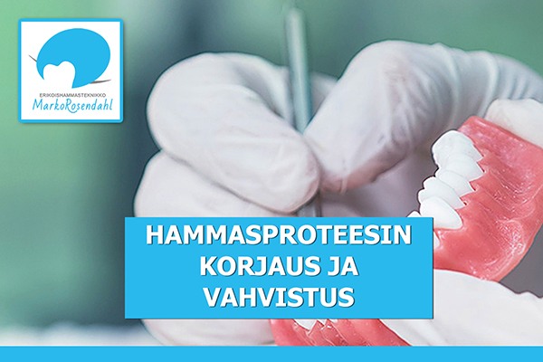 Hammasproteesin korjaus ja vahvistaminen hammasteknikko Marko Rosendahl Salo Lieto Paimio